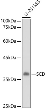 SCD1 Rabbit polyclonal antibody