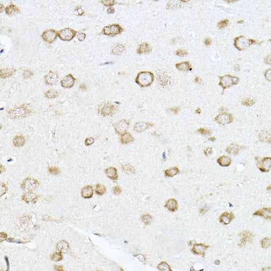 SCD1 Rabbit polyclonal antibody