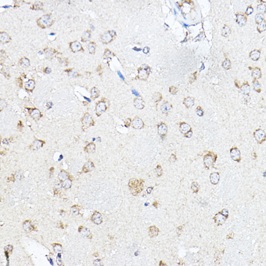 SCD1 Rabbit polyclonal antibody
