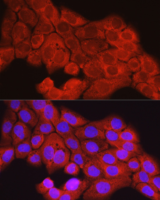 SCD1 Rabbit polyclonal antibody
