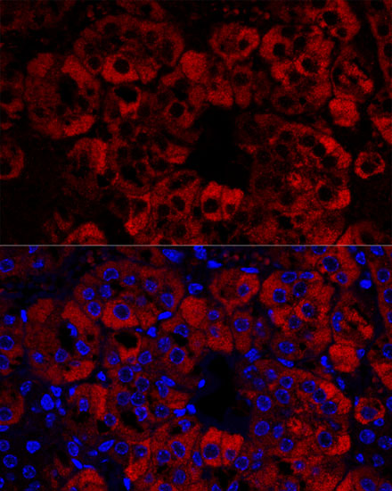 StAR Rabbit polyclonal antibody
