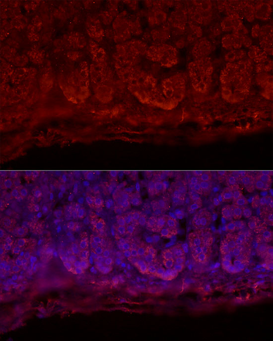 StAR Rabbit polyclonal antibody