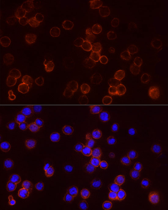 StAR Rabbit polyclonal antibody