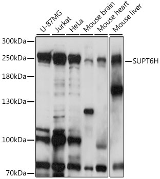 SUPT6H Rabbit polyclonal antibody