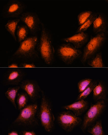 SUPT6H Rabbit polyclonal antibody