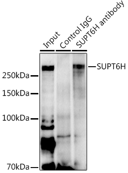 SUPT6H Rabbit polyclonal antibody