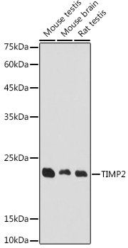 TIMP2 Rabbit polyclonal antibody