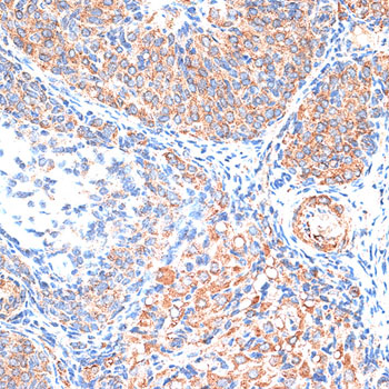 TIMP2 Rabbit polyclonal antibody