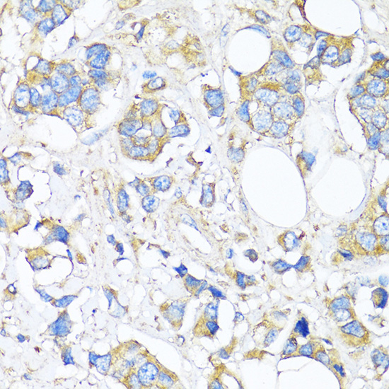 TIMP2 Rabbit polyclonal antibody