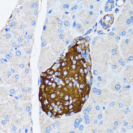 TIMP2 Rabbit polyclonal antibody