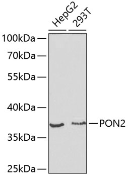 PON2 Rabbit polyclonal antibody