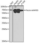 Western blot - Fetuin A/AHSG Rabbit pAb (A1647)