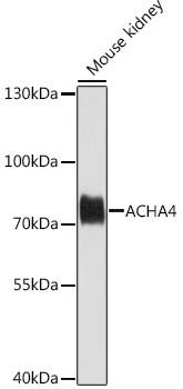 ACHA4 Rabbit polyclonal antibody