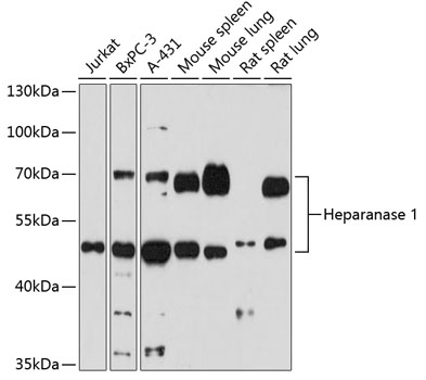 Heparanase 1 Rabbit polyclonal antibody
