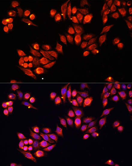 Heparanase 1 Rabbit polyclonal antibody
