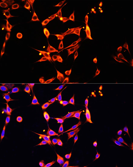 Heparanase 1 Rabbit polyclonal antibody
