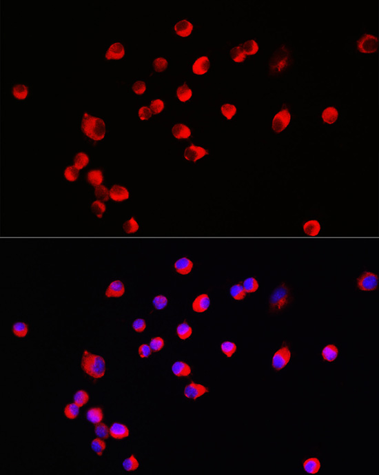 HRH3 Rabbit polyclonal antibody