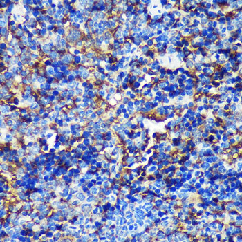CAND2 Rabbit polyclonal antibody