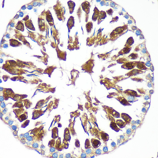 CAND2 Rabbit polyclonal antibody