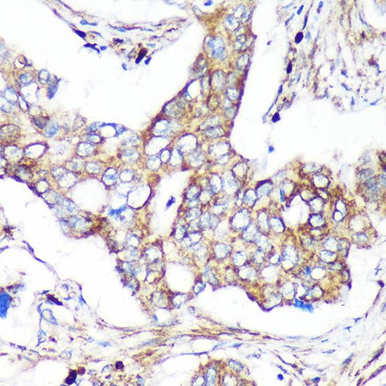 CAND2 Rabbit polyclonal antibody