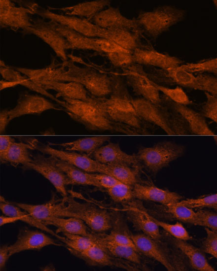 COMMD5 Rabbit polyclonal antibody