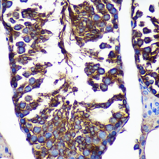 CTNNA3 Rabbit polyclonal antibody