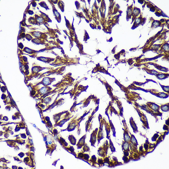 CTNNA3 Rabbit polyclonal antibody