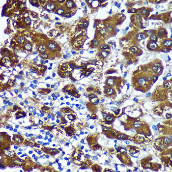 CTNNA3 Rabbit polyclonal antibody