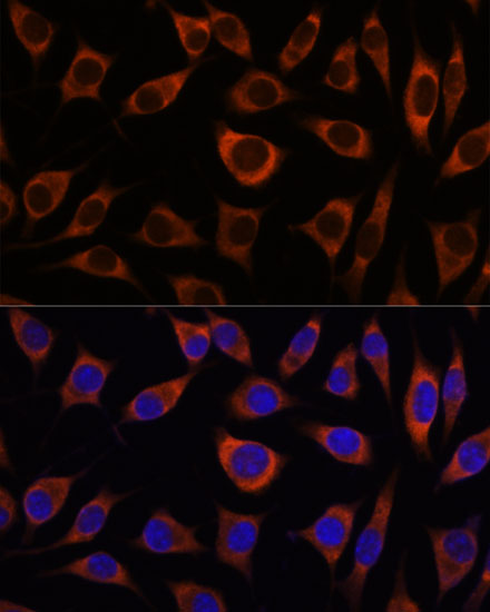 CTNNA3 Rabbit polyclonal antibody