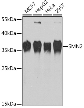 SMN2 Rabbit polyclonal antibody