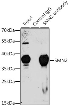 SMN2 Rabbit polyclonal antibody