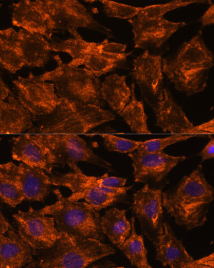 ITSN2 Rabbit polyclonal antibody