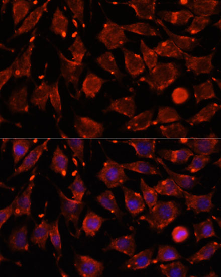 ITSN2 Rabbit polyclonal antibody