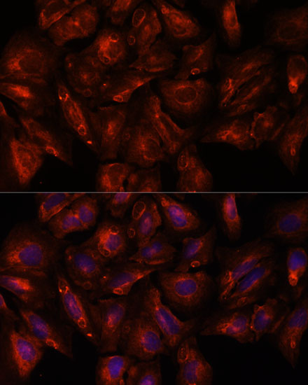 ITSN2 Rabbit polyclonal antibody