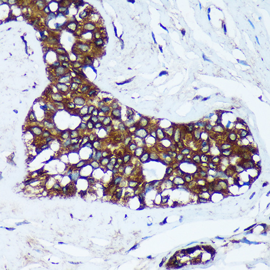 MRPL30 Rabbit polyclonal antibody