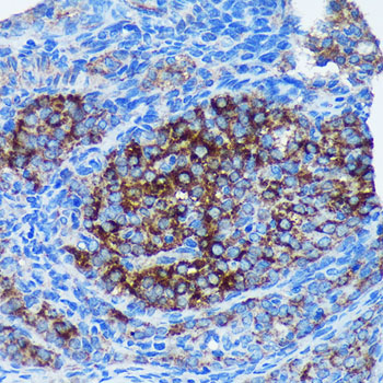 MRPL30 Rabbit polyclonal antibody