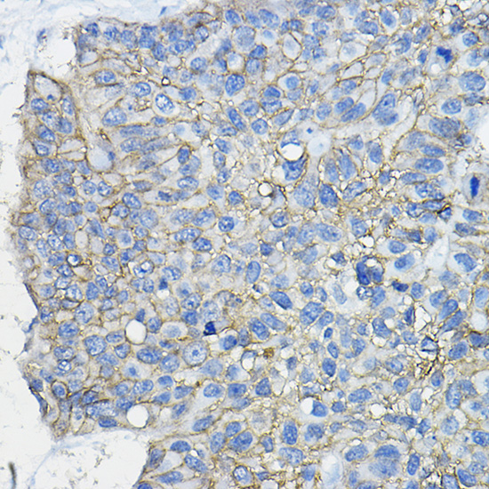 CD46 Rabbit polyclonal antibody