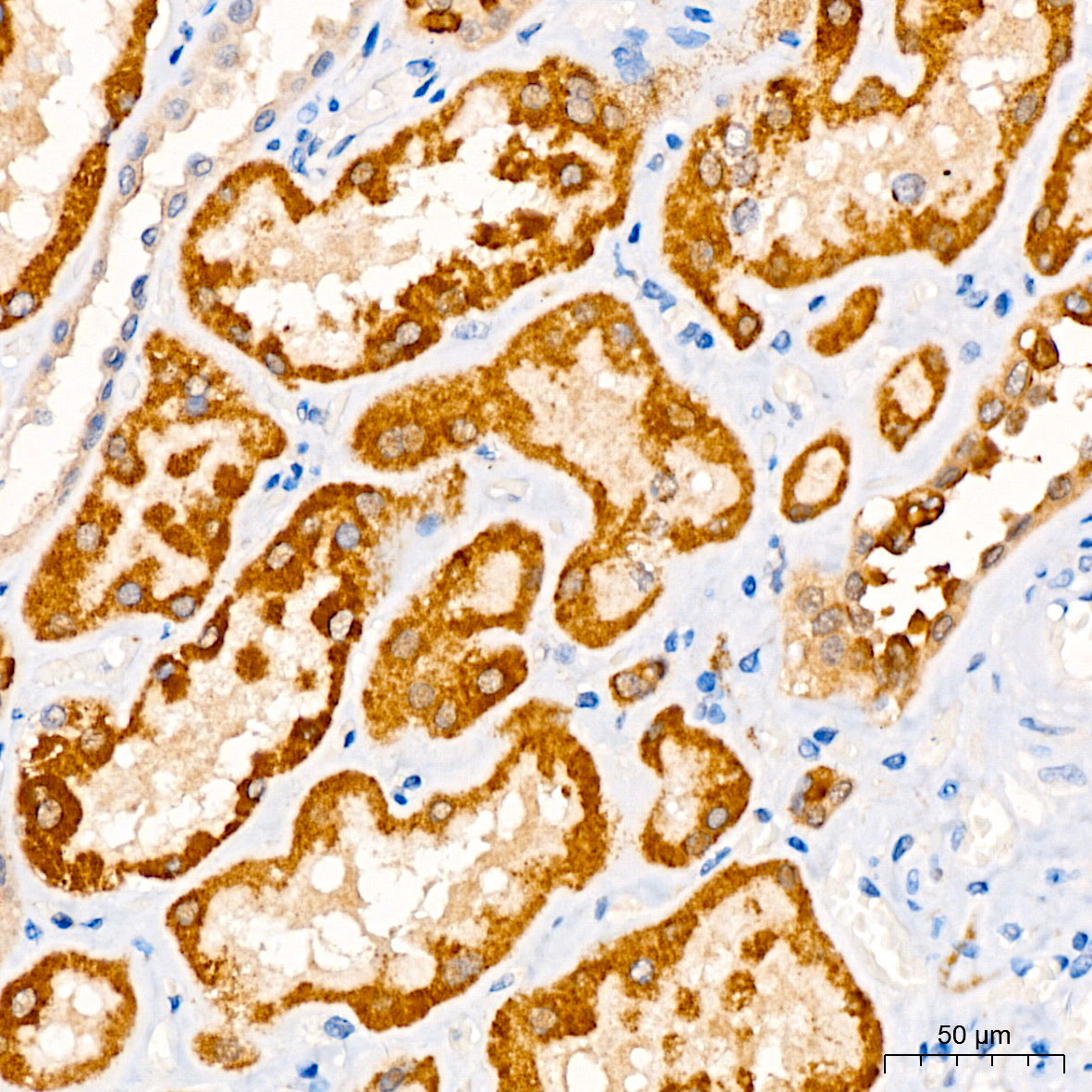 CHDH Rabbit polyclonal antibody