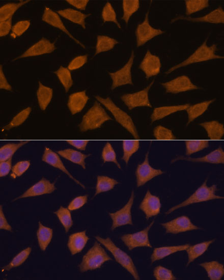 Septin 3 Rabbit polyclonal antibody