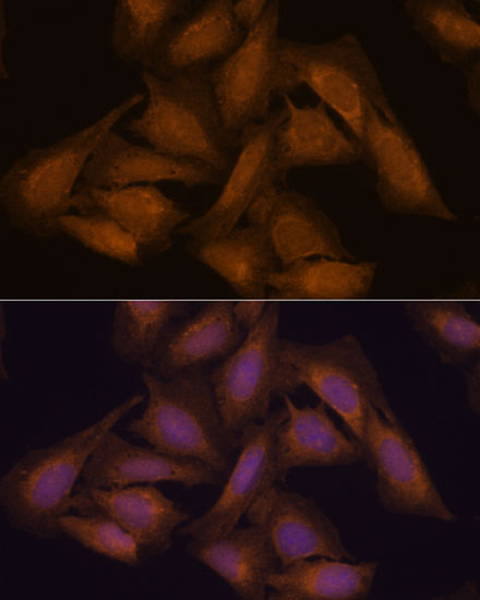 Septin 3 Rabbit polyclonal antibody