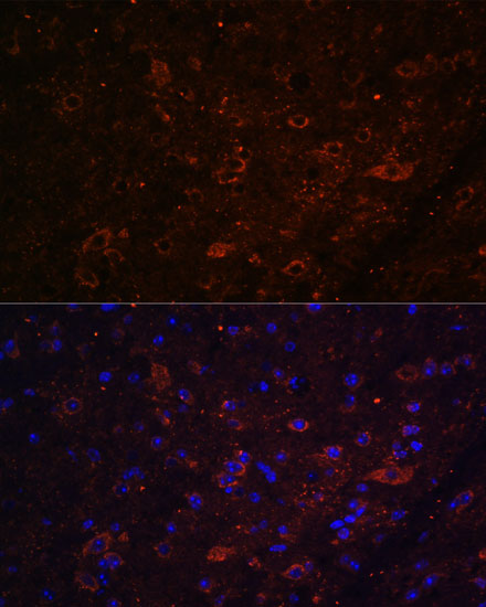 FSTL5 Rabbit polyclonal antibody