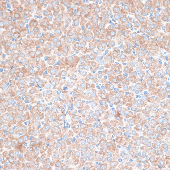 PMEPA1 Rabbit polyclonal antibody