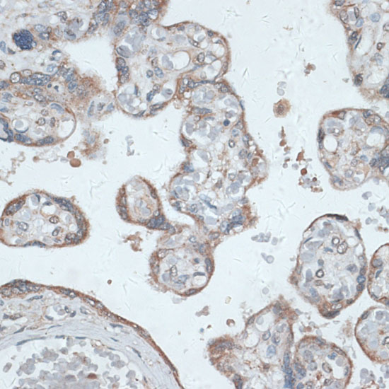 PMEPA1 Rabbit polyclonal antibody
