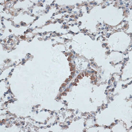 PMEPA1 Rabbit polyclonal antibody