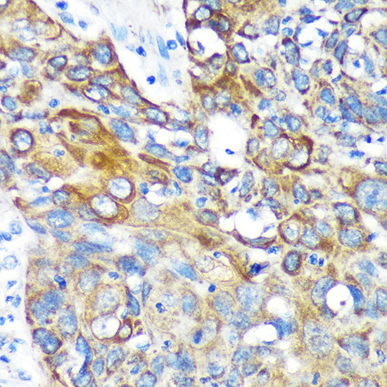 KIF17 Rabbit polyclonal antibody