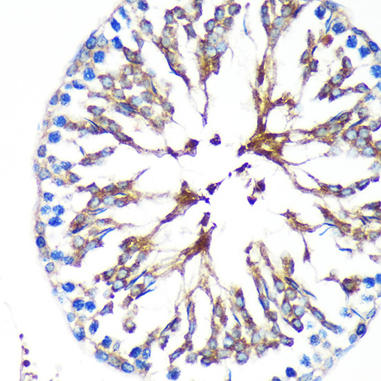 KIF17 Rabbit polyclonal antibody