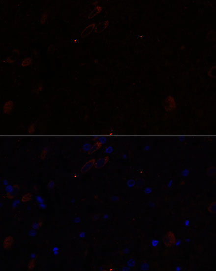 KIF17 Rabbit polyclonal antibody