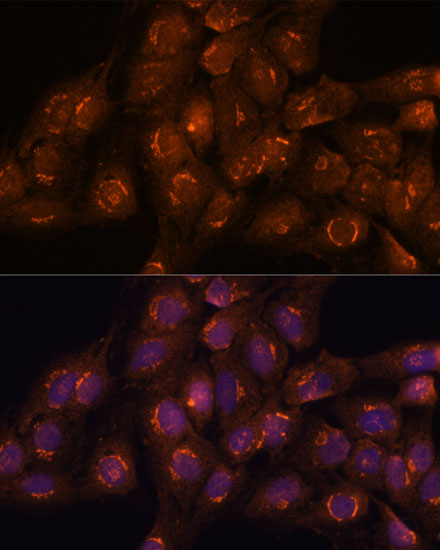 ACBD3 Rabbit polyclonal antibody