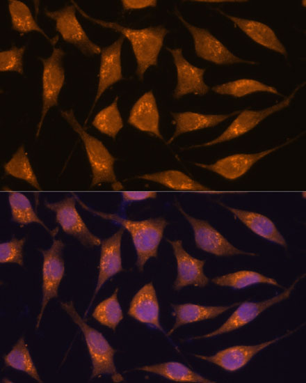 ACBD3 Rabbit polyclonal antibody
