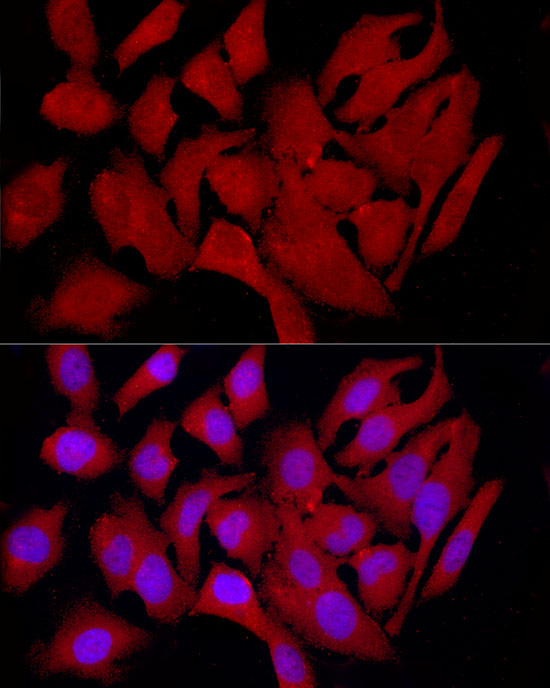 COLGALT1 Rabbit polyclonal antibody